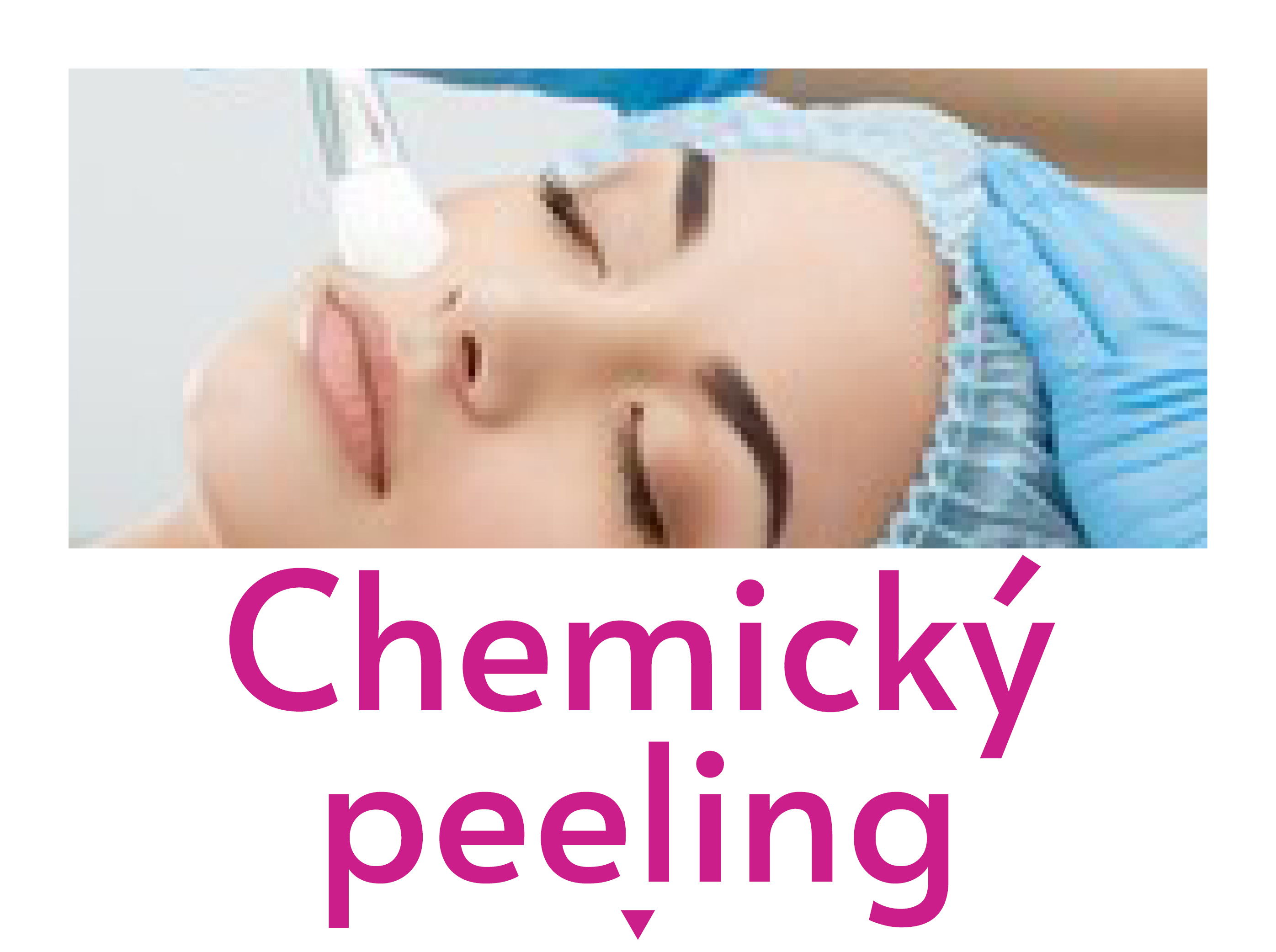 Chemický peeling