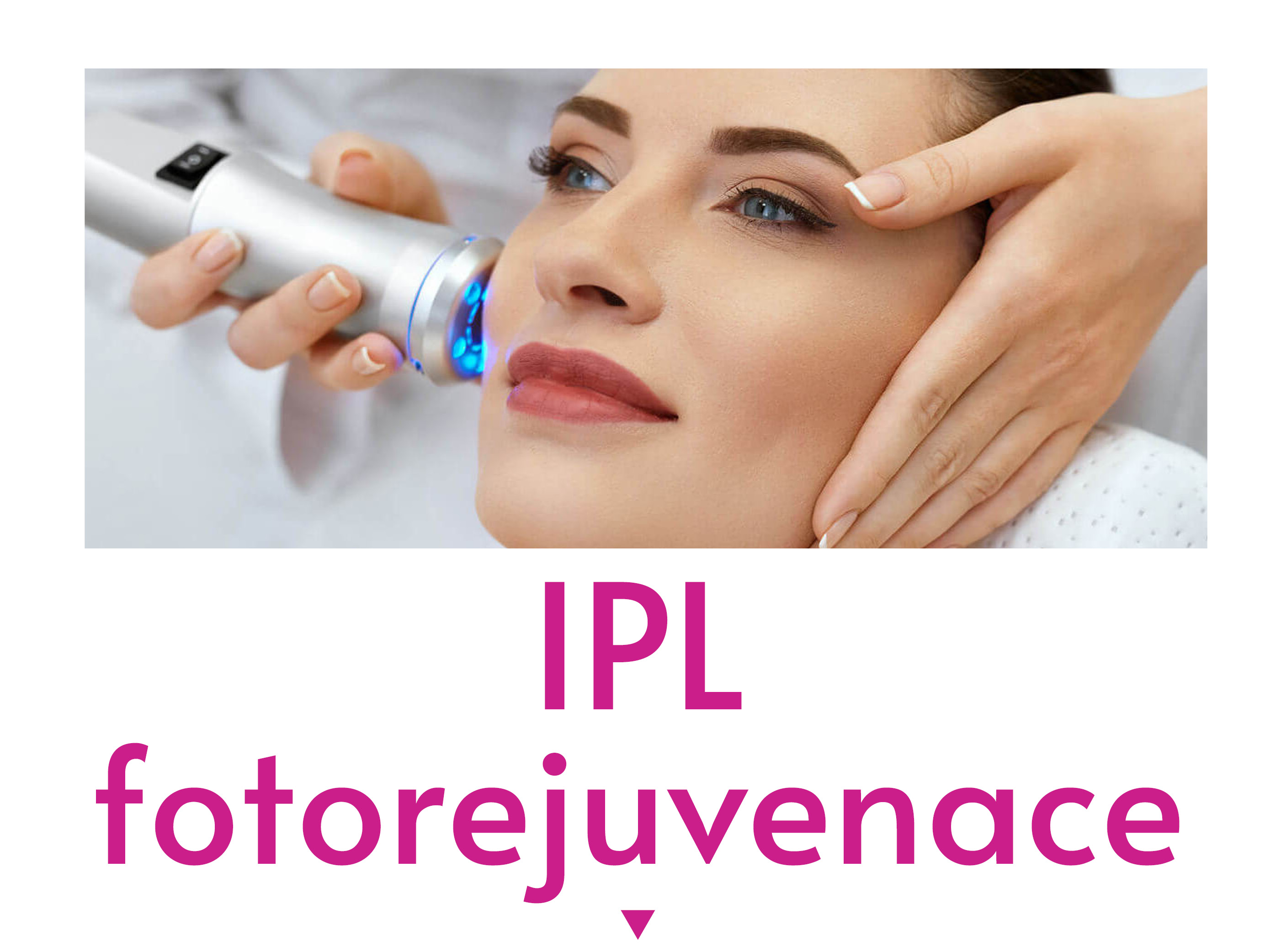 IPL fotorejuvenace