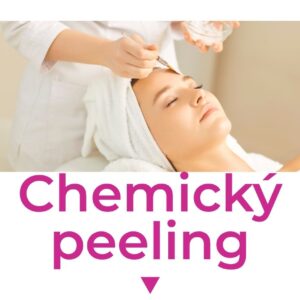Chemický peeling