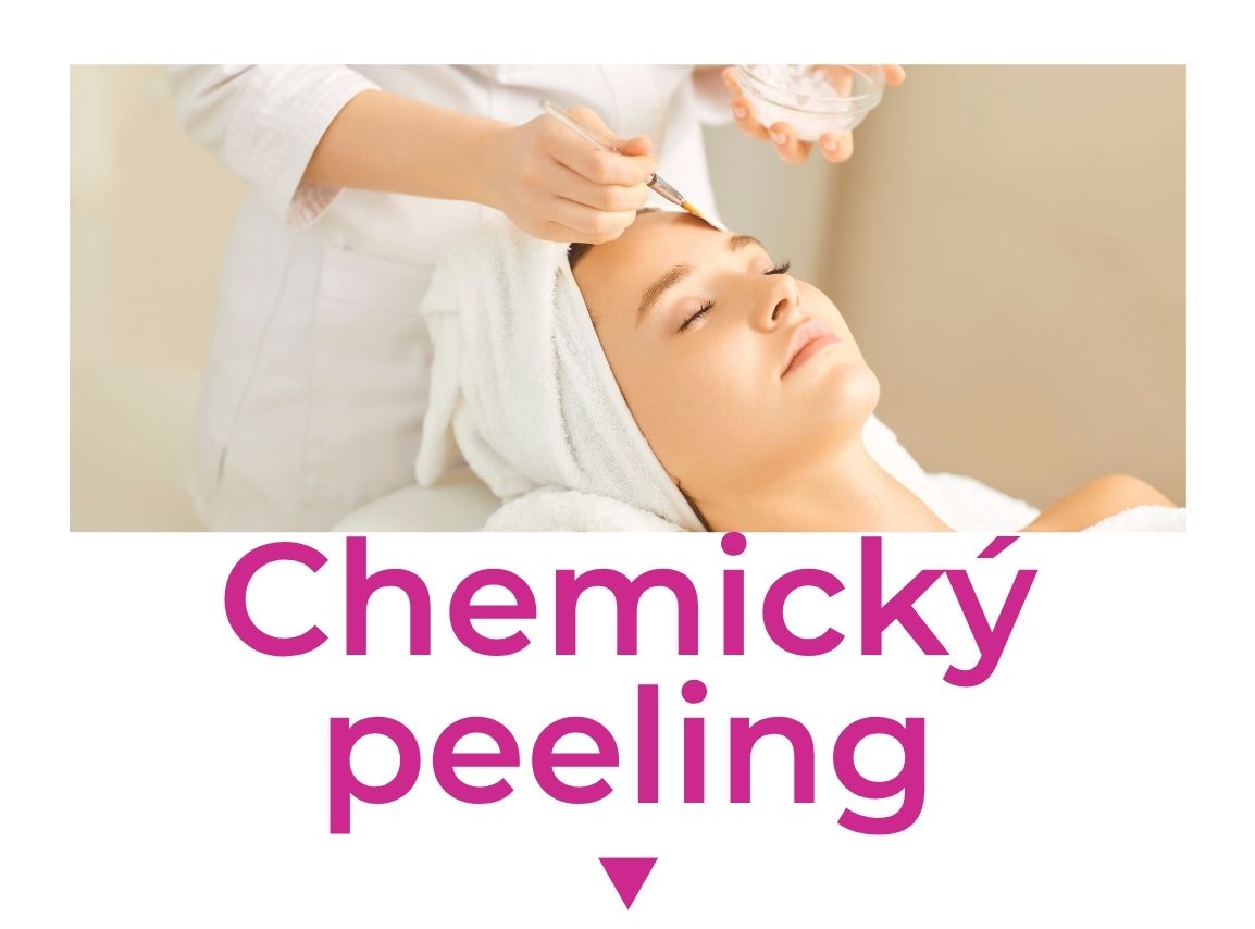Chemický peeling