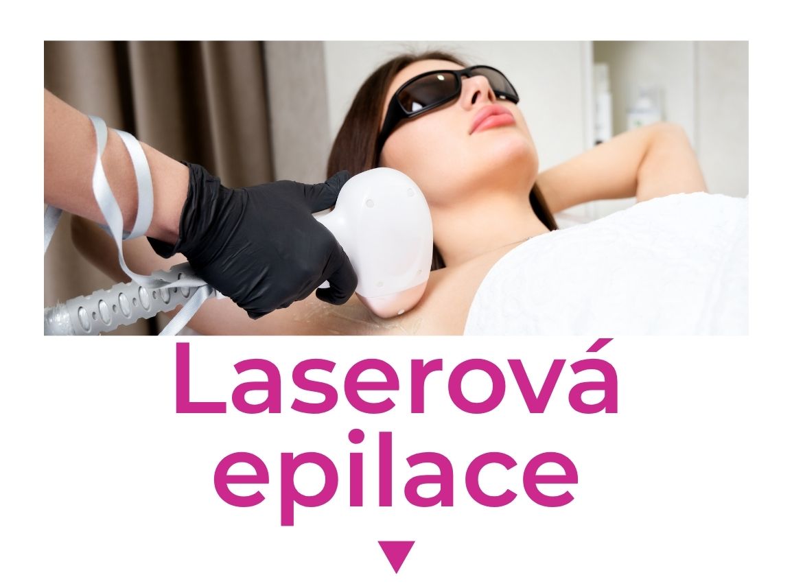 Laserová epilace